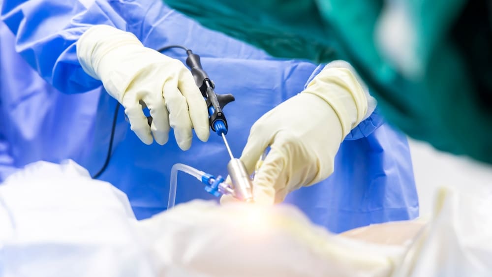 What To Expect Before, During, and After Surgery