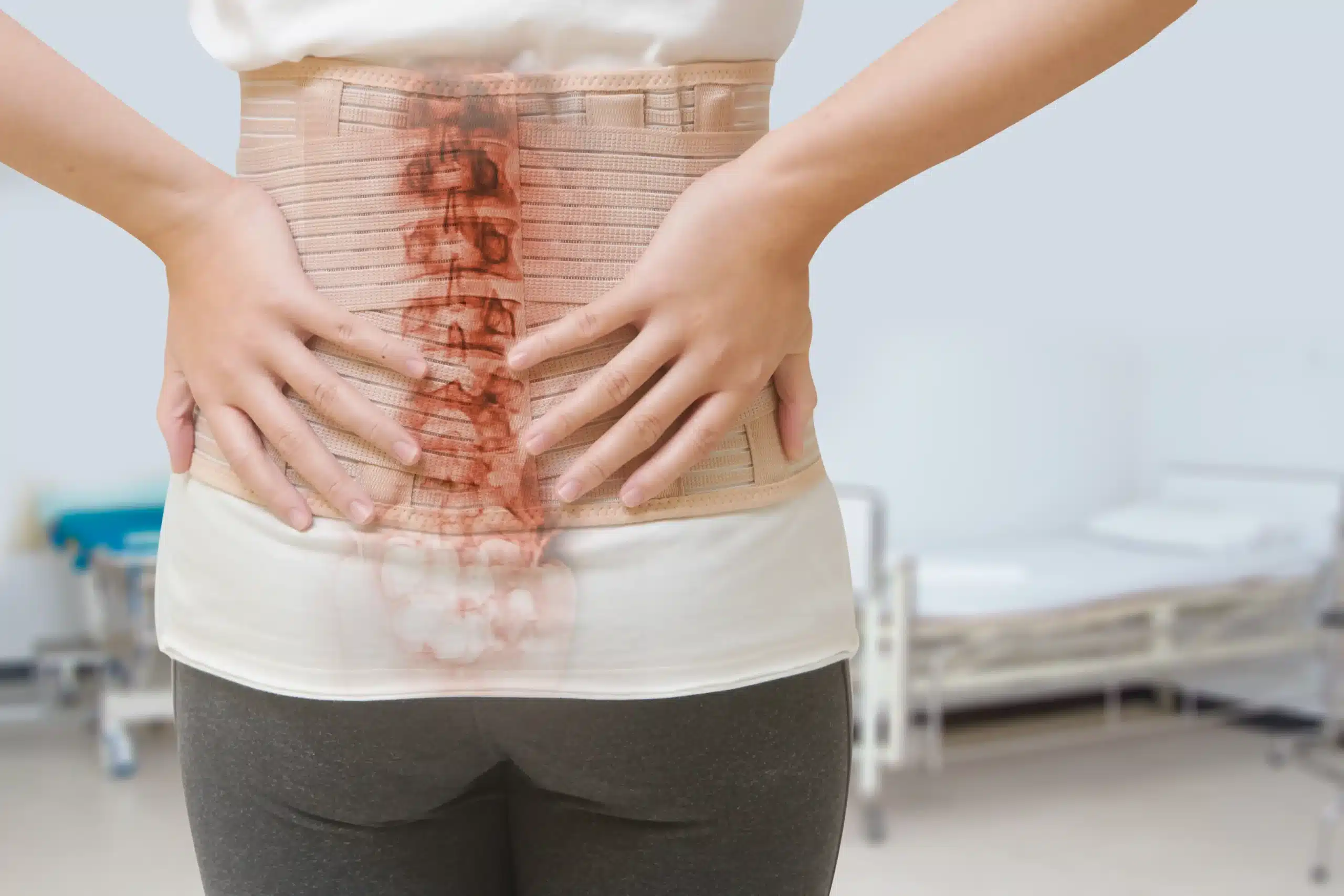 Woman experiencing back pain wearing a lumbar brace corset for spinal injury prevention