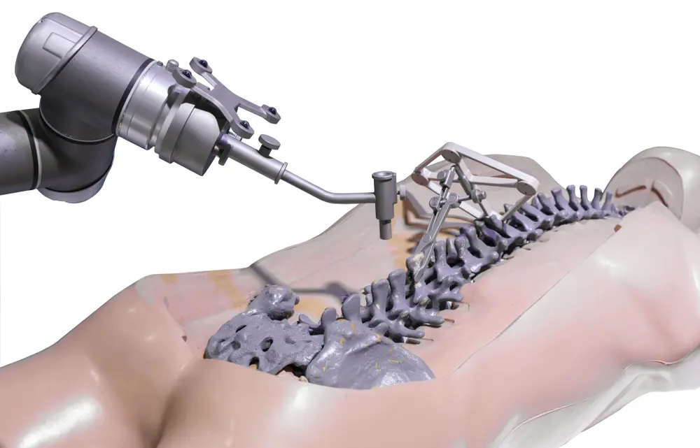 3D surgical robot module for robotic-assisted spinal surgery, demonstrating precision technology.