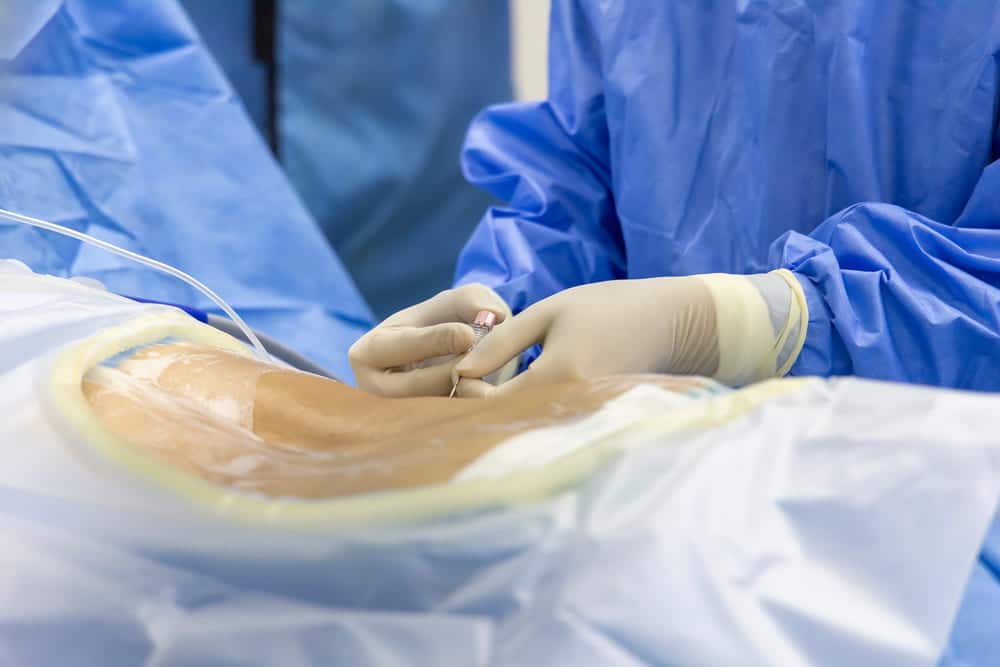 Lumbar Microdiscectomy